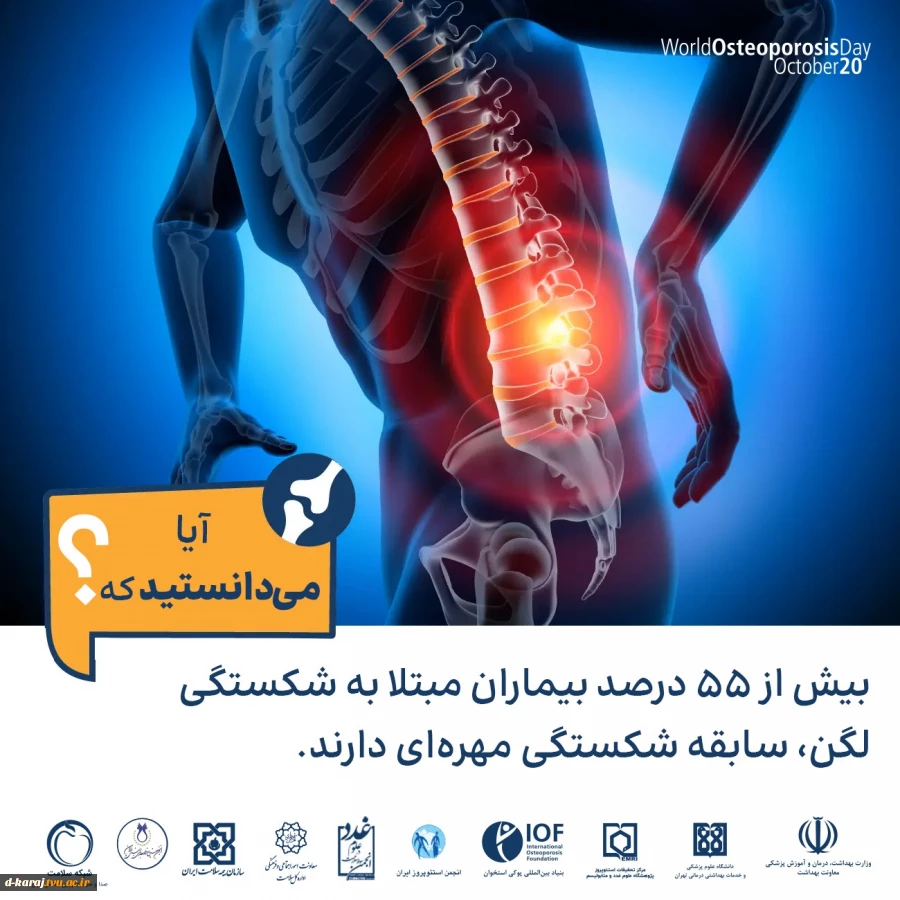 راهنمای جامع پوکی استخوان 9