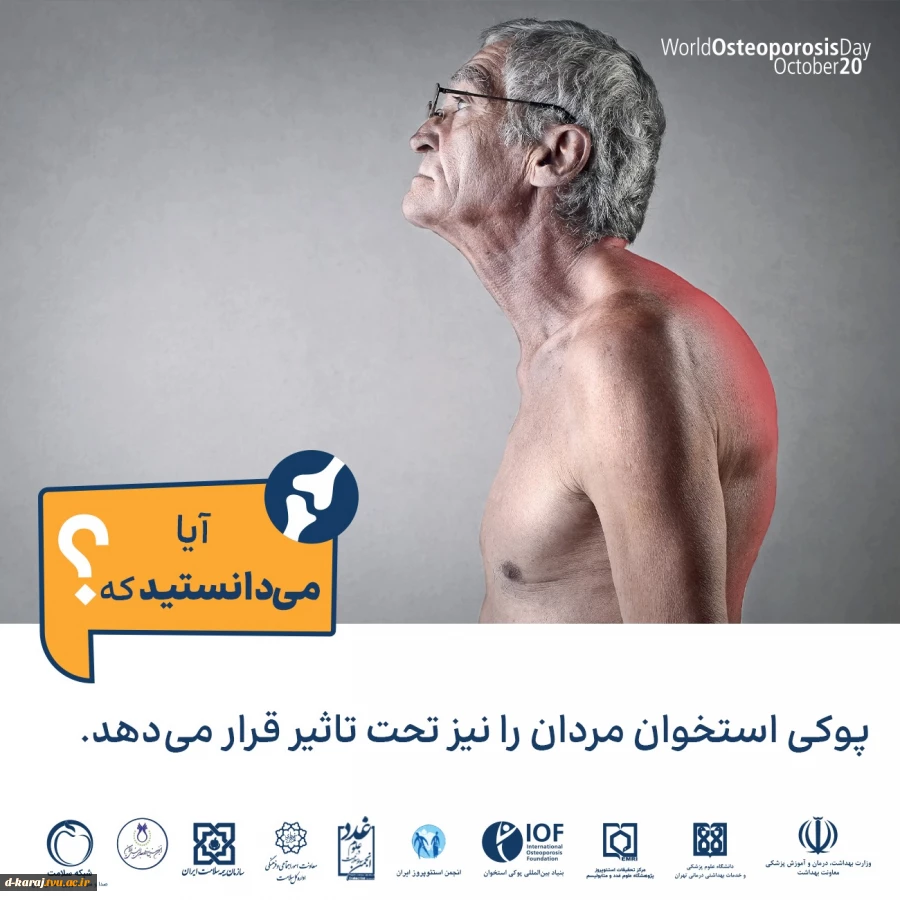 راهنمای جامع پوکی استخوان 11